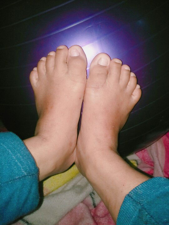 hamil umur 25 minggu