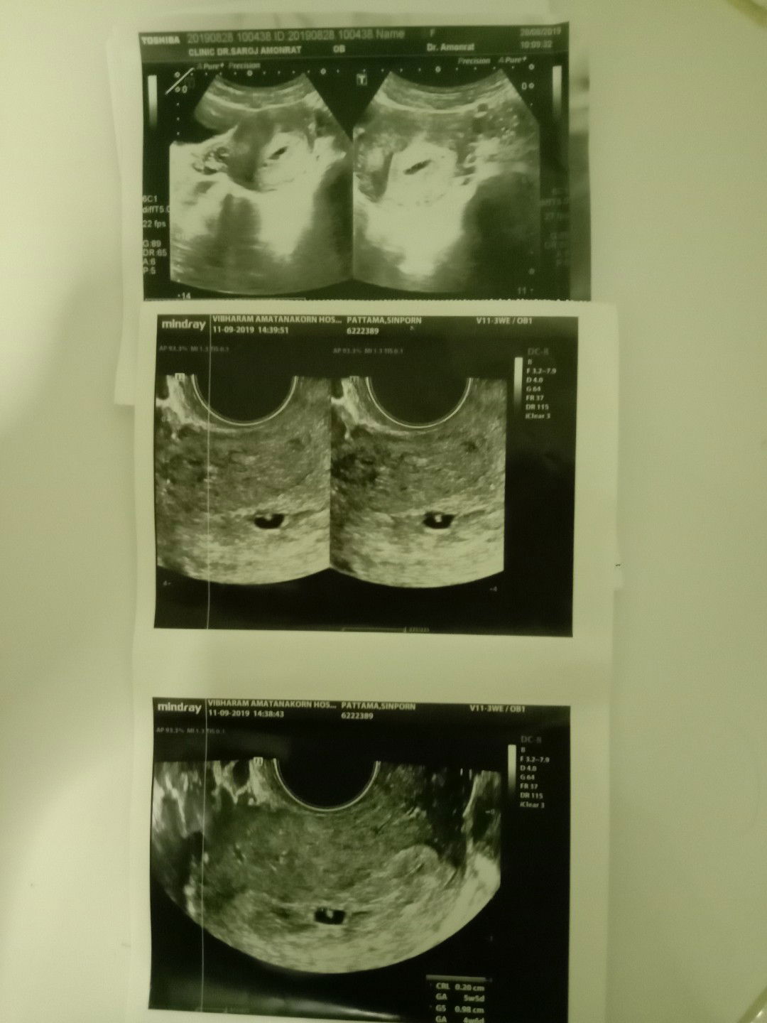 ขอสอบถามค่ะ  แม่ยังมีหวังไหมค่ะ