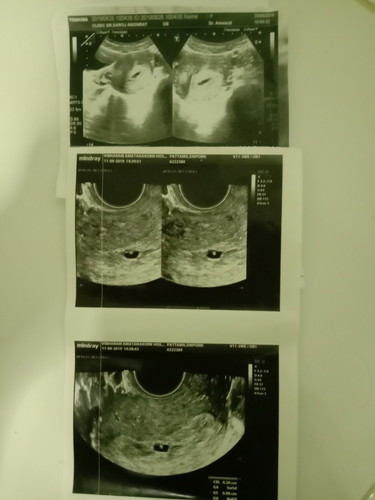 ขอสอบถามค่ะ แม่ยังมีหวังไหมค่ะ