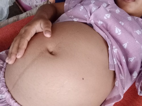 ท้องแบบนี้ชายหรือหญิงค่ะ