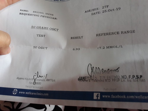 50 OGCT SUGAR TEST