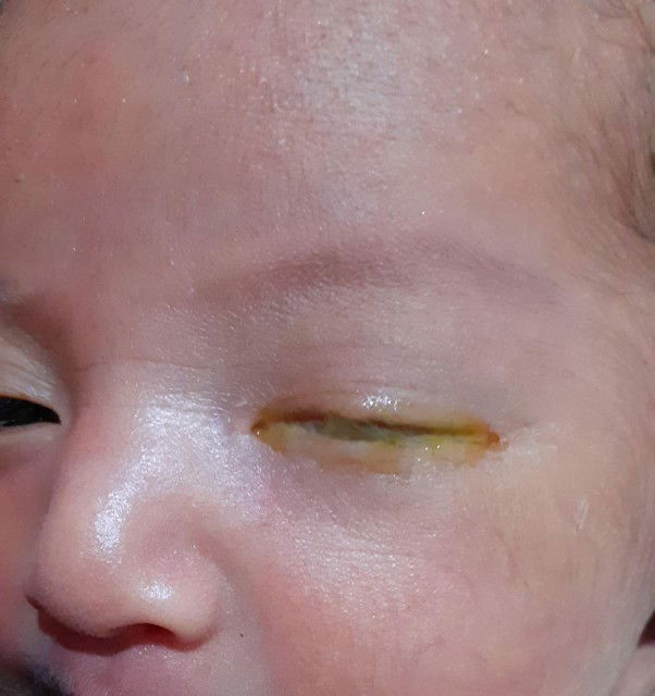 bun tolong ini kenapa? apa masih normal?? bayi baru 3 hari bun