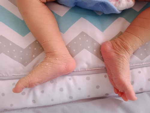 natural lang ba ito?