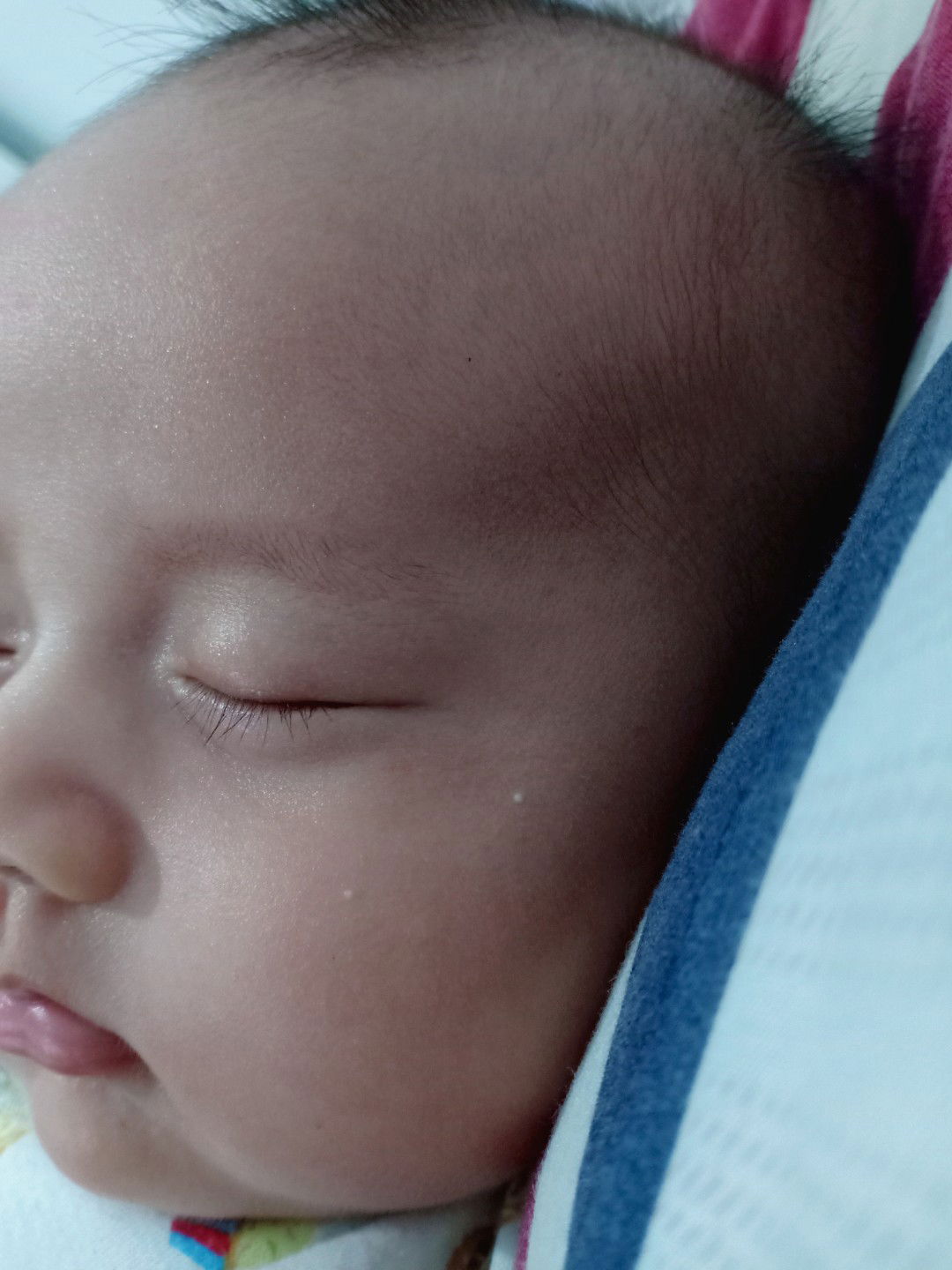 Bintik bintik pada bayi