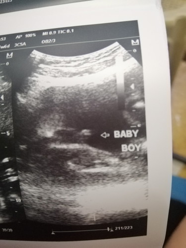 Its A Boy