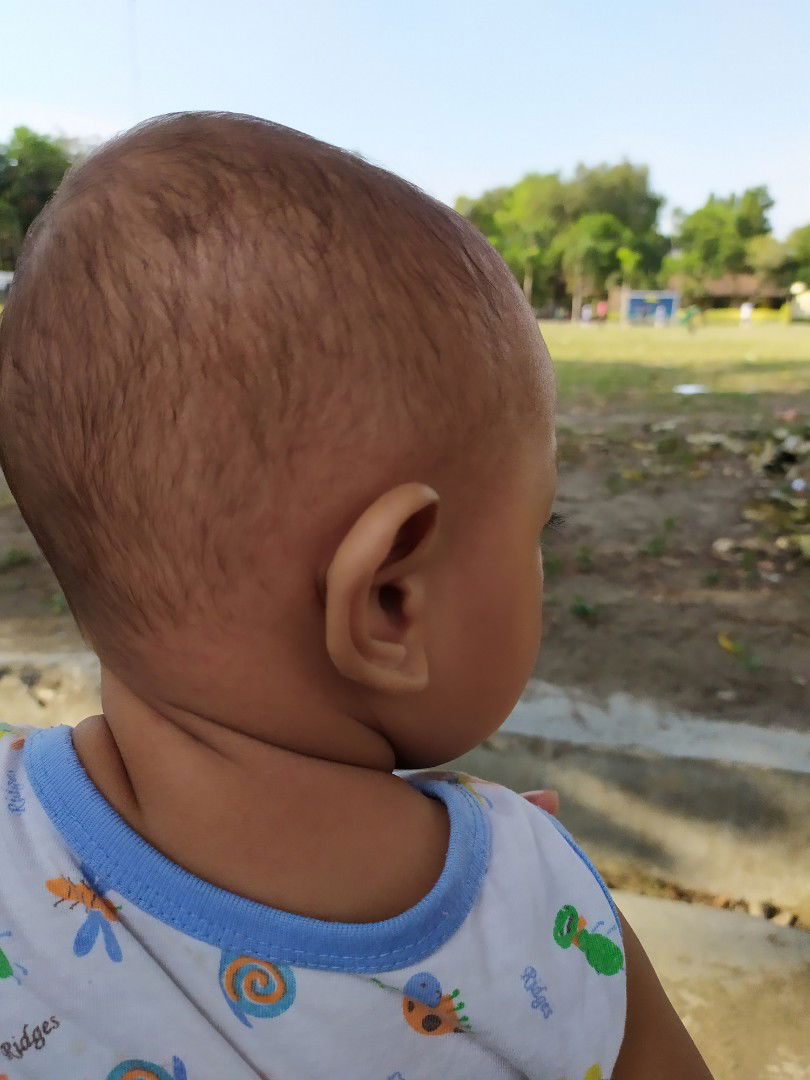 anka 11 bulan belum berambut