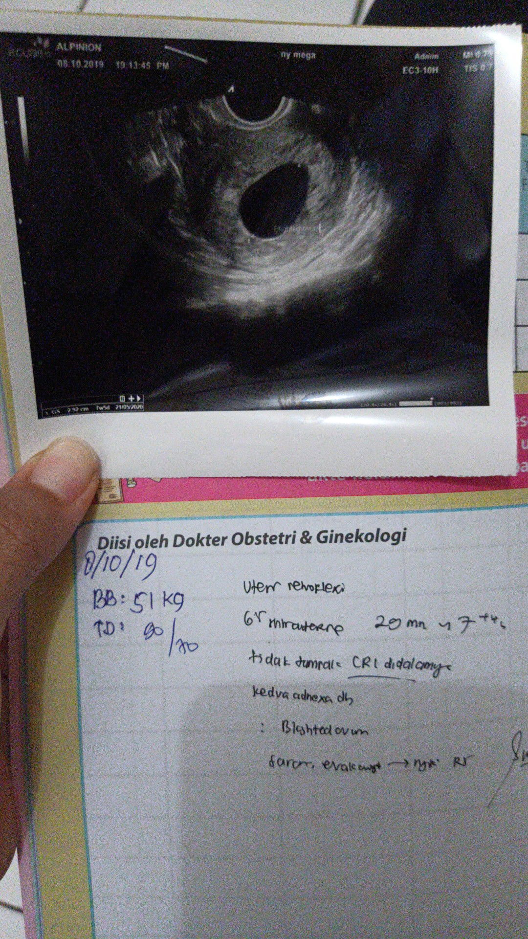 hamil keluar darah menstruasi