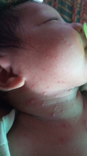 ทำยังไงน้องถึงจะหายช่วยแนะนำที