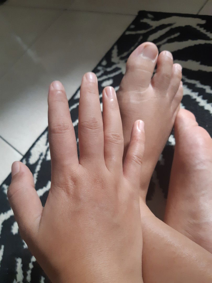 kaki tangan bengkak usia kandungan 5 bulan