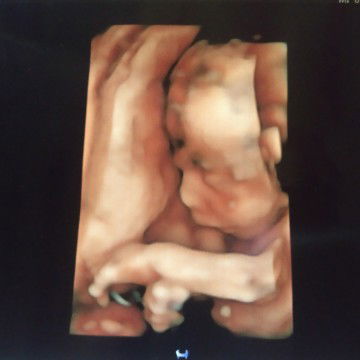 Persiapan persalinan