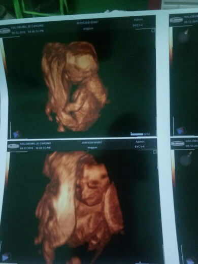 Anggoens profile icon