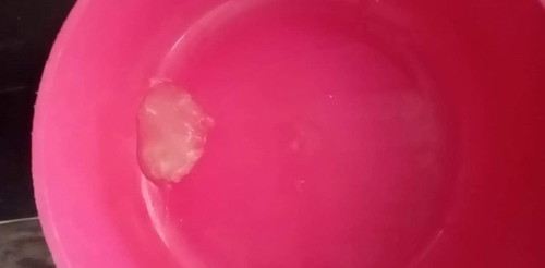 มูกสีขาวขุ่น