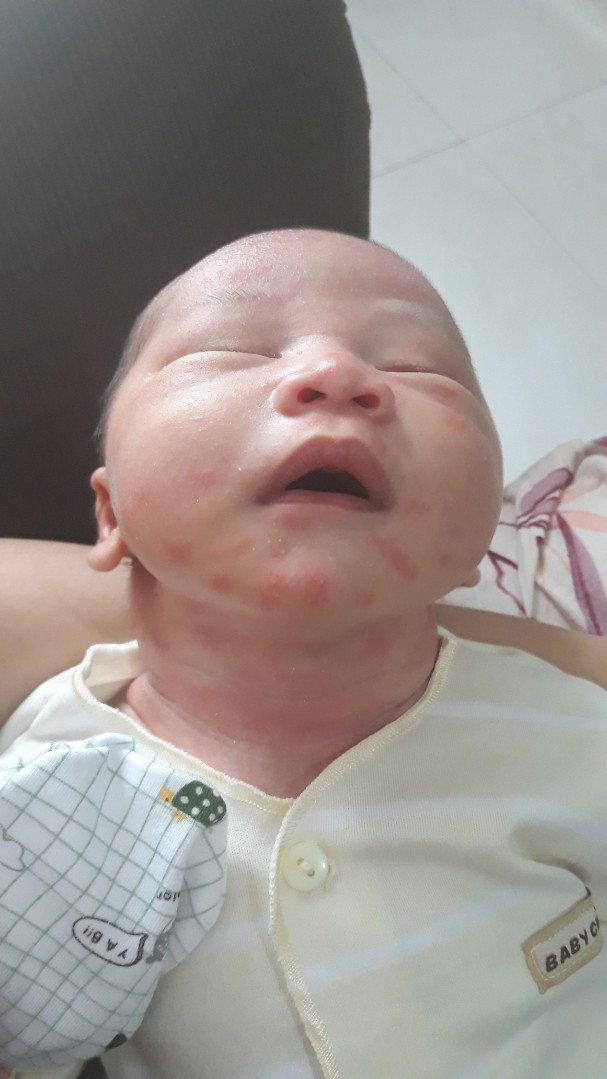 kulit merah2