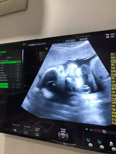 29W 3D