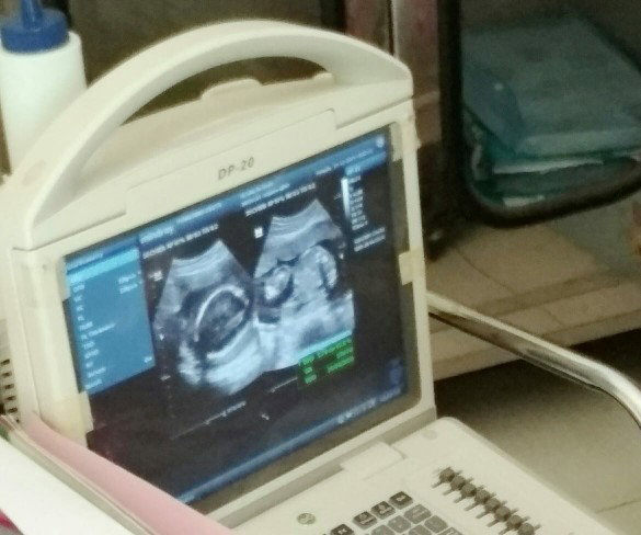 Anak tak di harapkan mertua