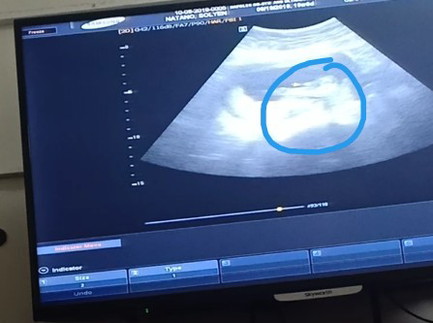 3 months ultrasound