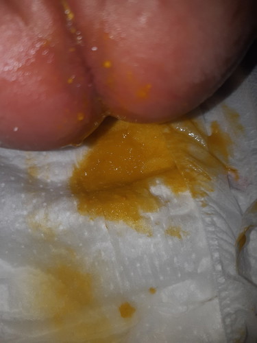 ลูกป่วยหรือป่าว