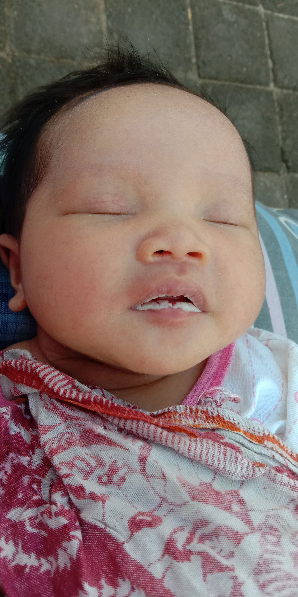 mulut bayi
