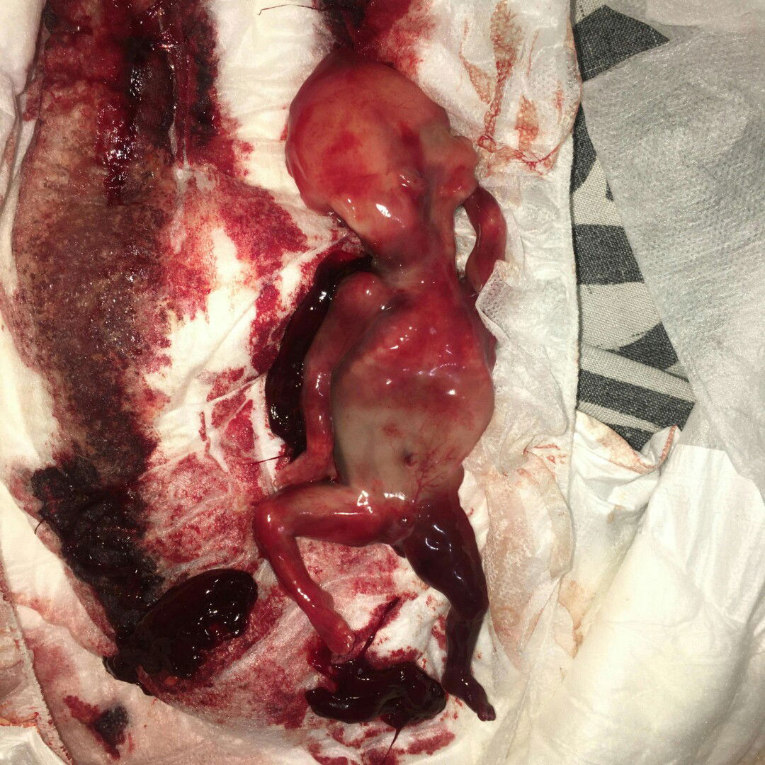 Goodbye my little angel ?