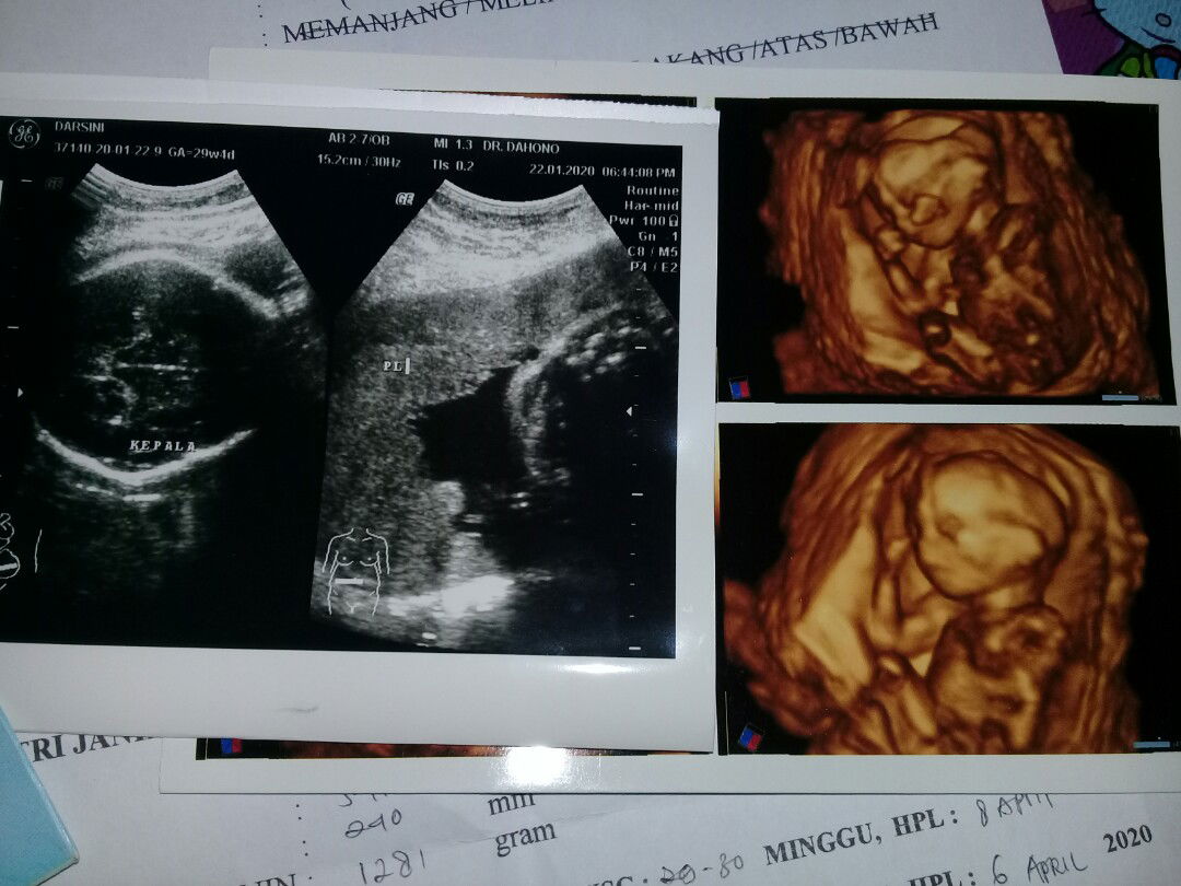 yng terpenting yakin