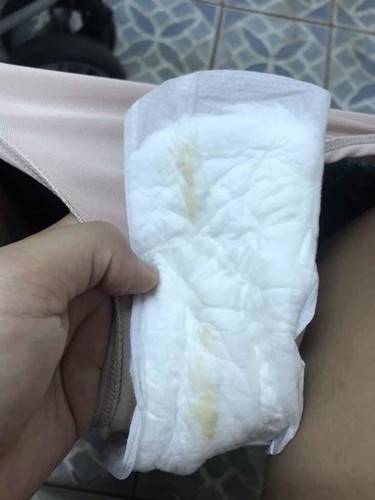 ขออภัยในภาพที่ไม่เหมาะสม