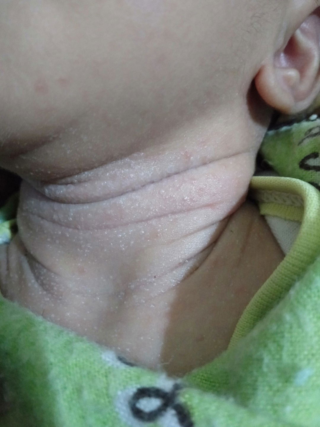 entah biang keringet ataw bkn.