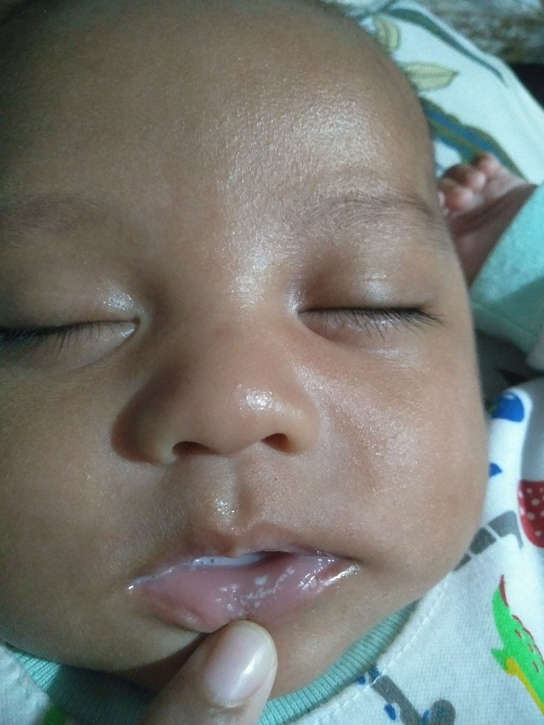 putih2 di bibir dan lidah