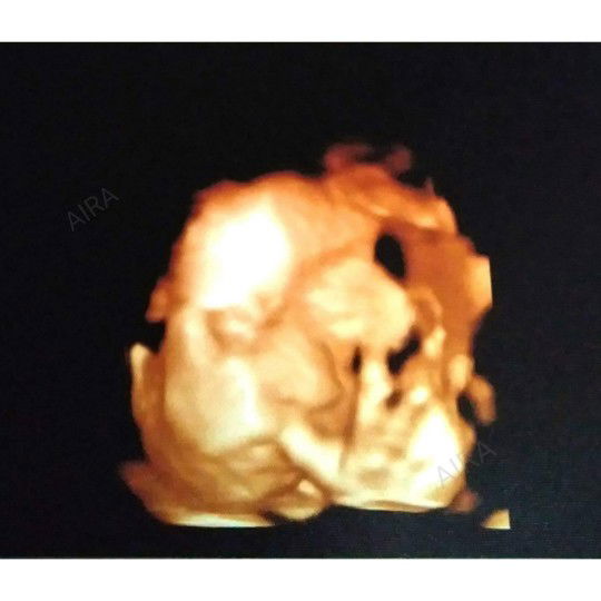 Spongebabe profile icon