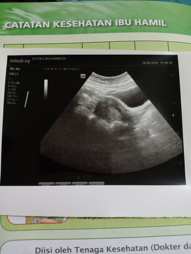 hamil usia 5 week