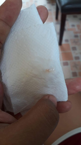 ใช่มูกใสปนเลือดมั้ยคะ