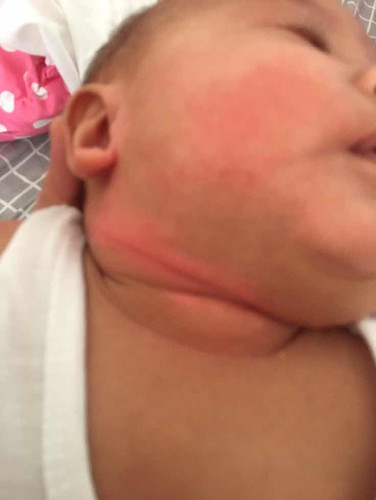 Ano po gamot sa leeg?