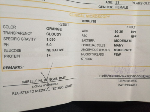 URINALYSIS RESULT