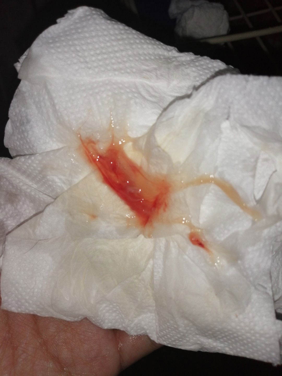 Mucus Plug Naba Ito?