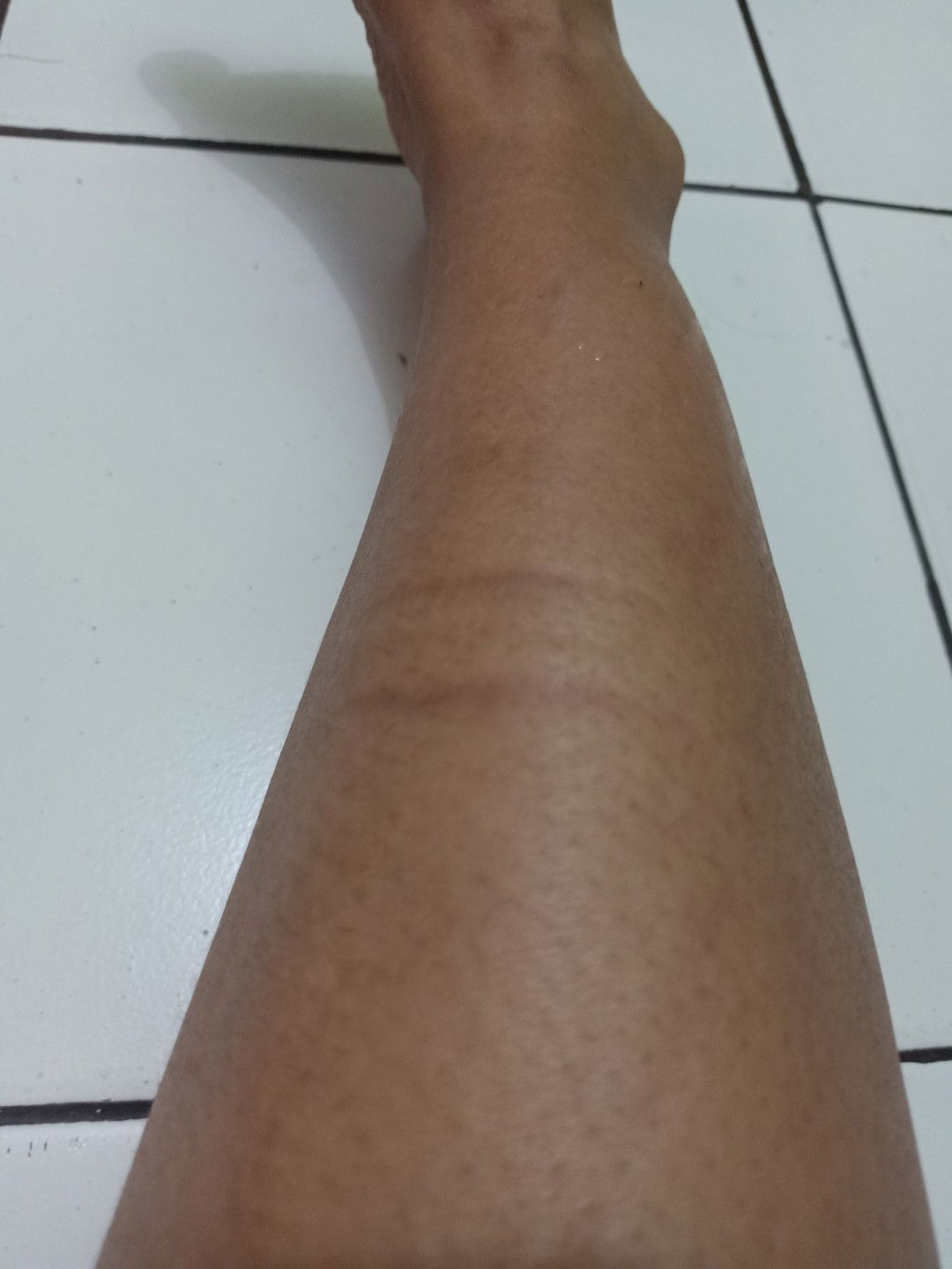 ada garis dalem banget kalo diraba