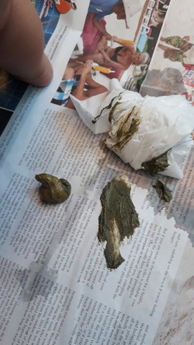 ลูกถ่ายเปนสีนี้ปกติไหม