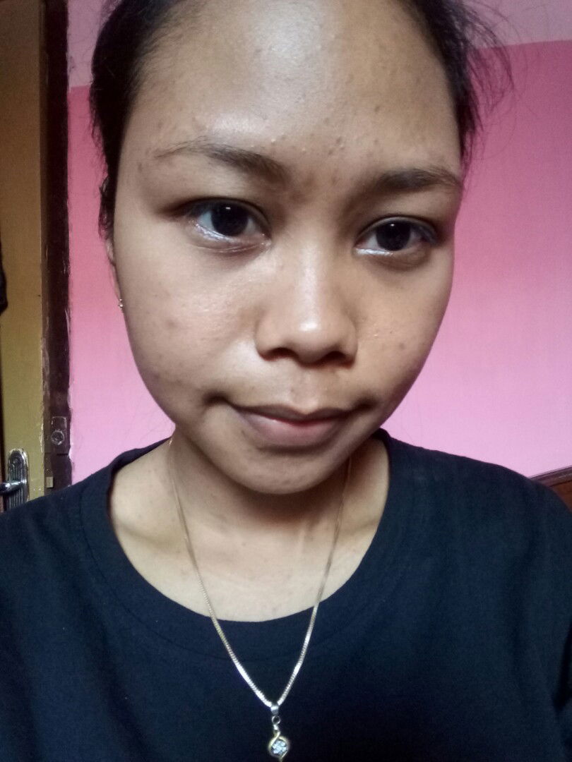 skincare buat ibu hamil