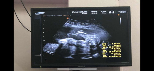 19 w 5 d ไปซาวด์มาค่ะ ช่วงนี้ดูเพศยังมีโอกาสพลาดไหมคะ