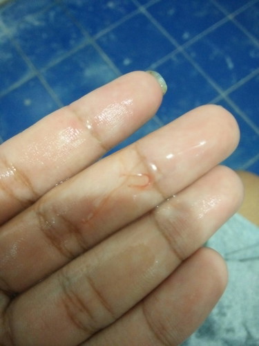 เลือดออก