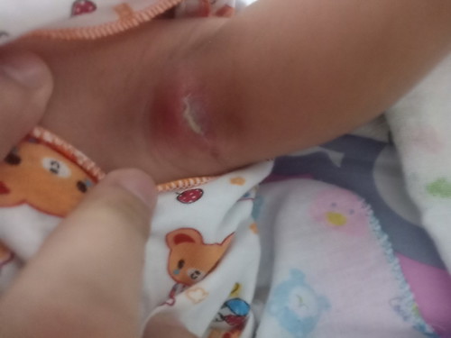 เป็นคราบ