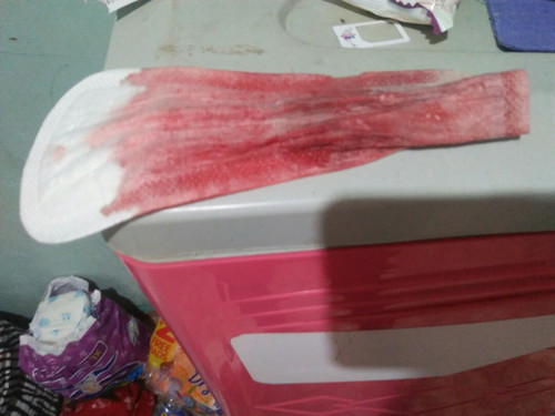 bleeding