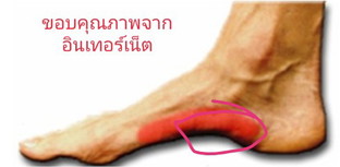 คุณแม่ท่านไหนประสบปัญหาปวดเท้าด้านข้างบ้างไหมคะ