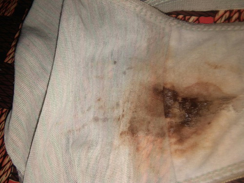 brown discharge