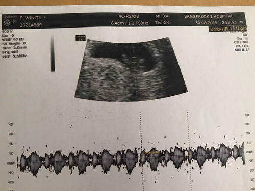 ลูกของเราตัวเล็กไปไหมค่ะ????