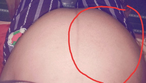 grabeeee ang siksik nya sa right tummy ko... :(