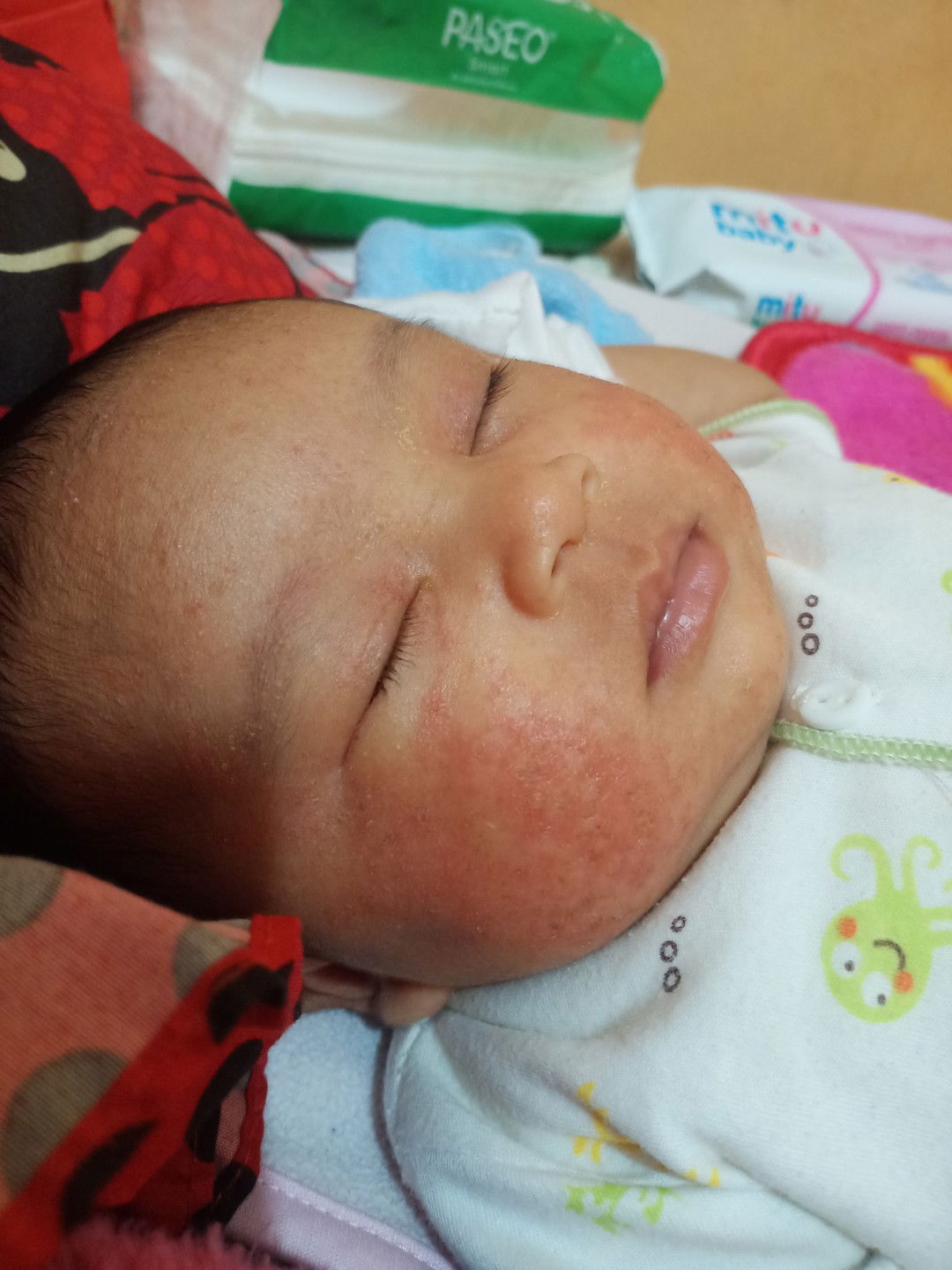 kulit kering, merah, dan mengelupas