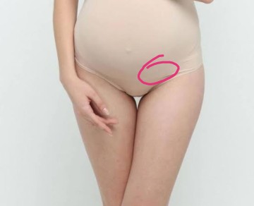 ตั้งครรภ์ได้20 W ค่ะ