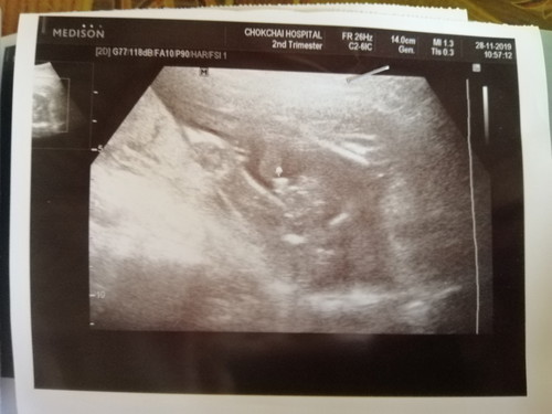 มาอวดลูกชายกันค่ะ
