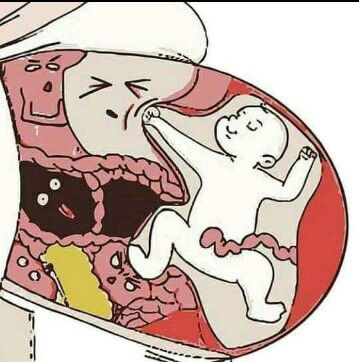 cerita sedikit cara cepat hamil