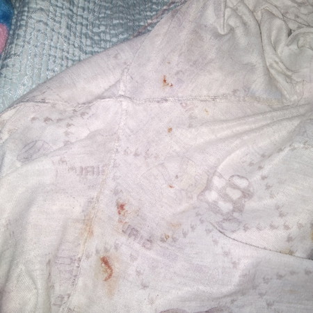 มีเลือดออก แต่ไม่เจ็บท้อง ท้องไม่แข็ง