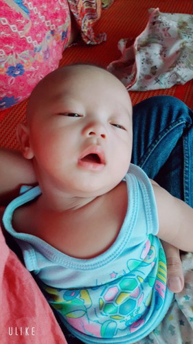 คัดจมูก
